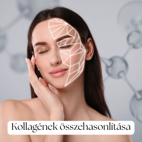Melyik kollagén felel meg a céljaidnak?